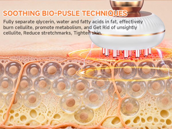 Anit Cellulite