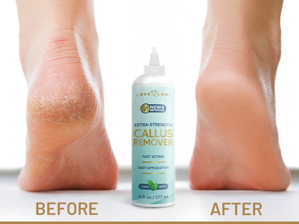 Before/After