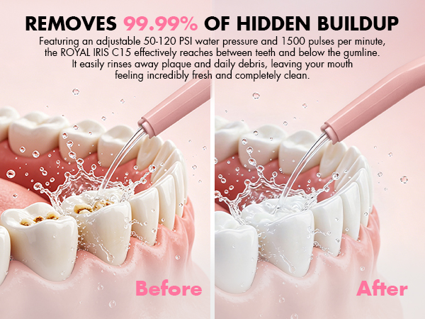 water picks for teeth cleaning and flossing