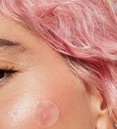 pimple patches