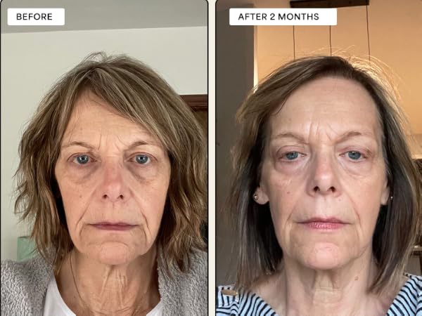 Visible Results in Just 2 Weeks