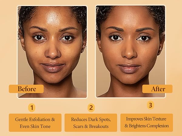 kojic soap for women and men
