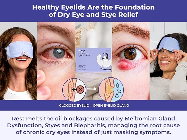 Meibomian gland dysfunction treatment clogged oil gland eye mask blepharitis relief therapy pads