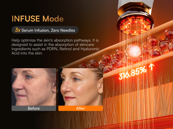 INFUSE Mode