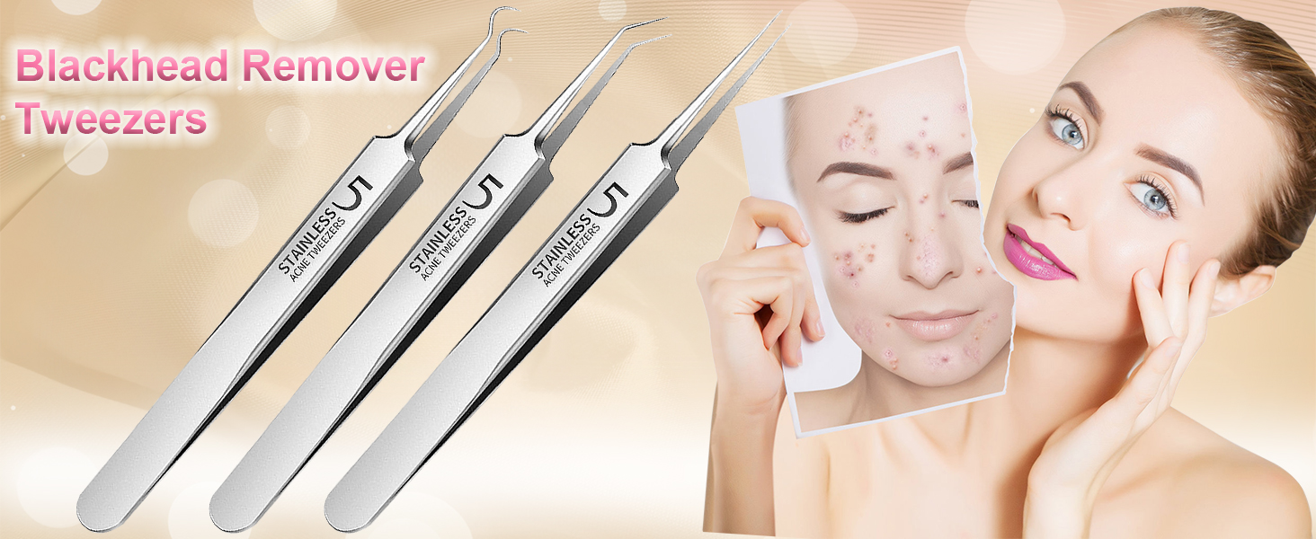 Blackhead tweezers