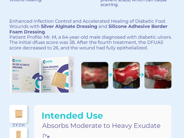 4x4 foam dressing