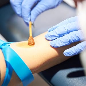 Nurse applying McKesson PVP Prep Solution before collecting blood sample