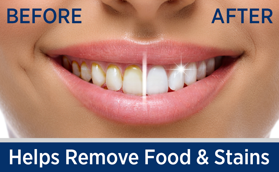 Helps Remove Food & Stains