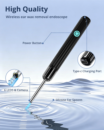 ear cleaning camera