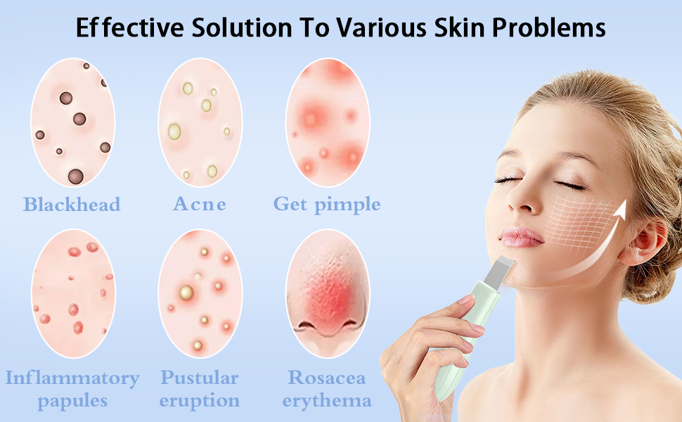 blackhead remover tools