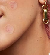 pimple patches