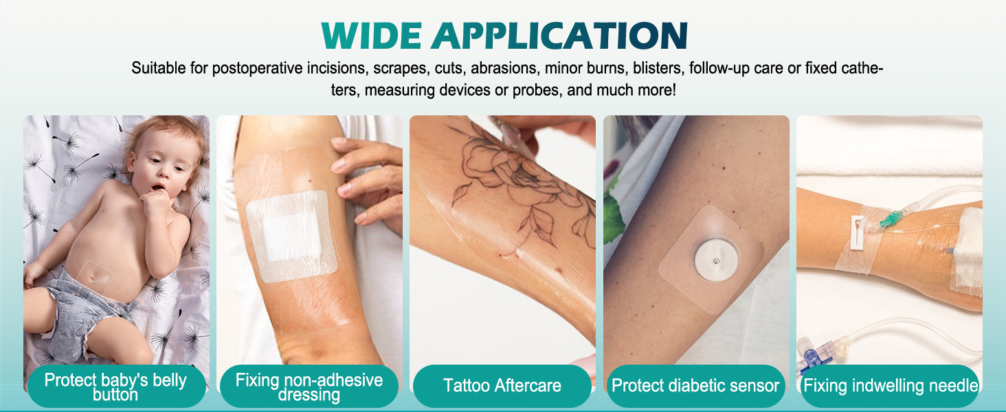 tegaderm transparent dressing