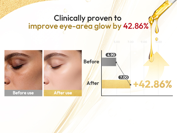 Clinically proven to improve eye-area glow by 42.86%