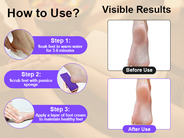 Dead Skin Remover