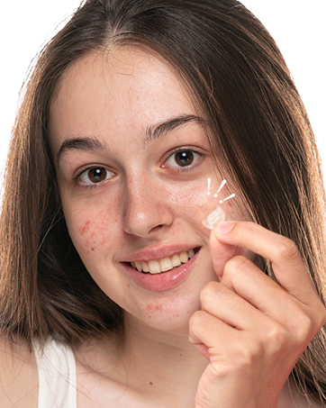 acne patches