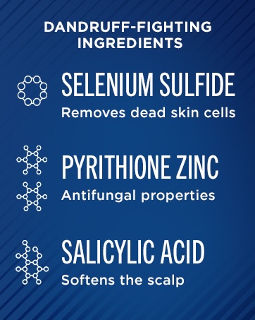 best itchy scalp treatment