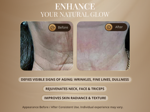 GLO24K Red Light Face & Neck Beauty Device
