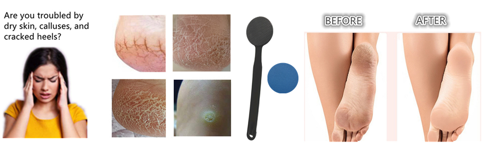 2-in-1 Nano Glass Foot File Callus Remover