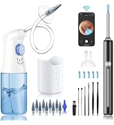 Ear Wax Removal - Ear Cleaner - Ear Camera - Ear Wax Removal Kit - Ear Wax Removal Tool Camera - ...