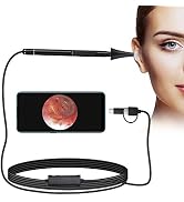 Jiusion 3.9mm Ultra-Thin Portable USB Digital Otoscope Camera with Carrying Case, HD 720P 6 LED V...