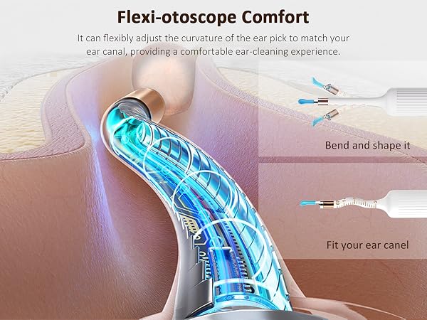 earwax removal kit with camera