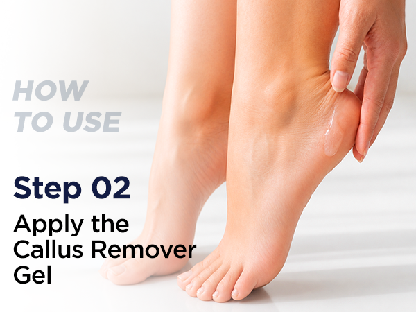 Callus Remover