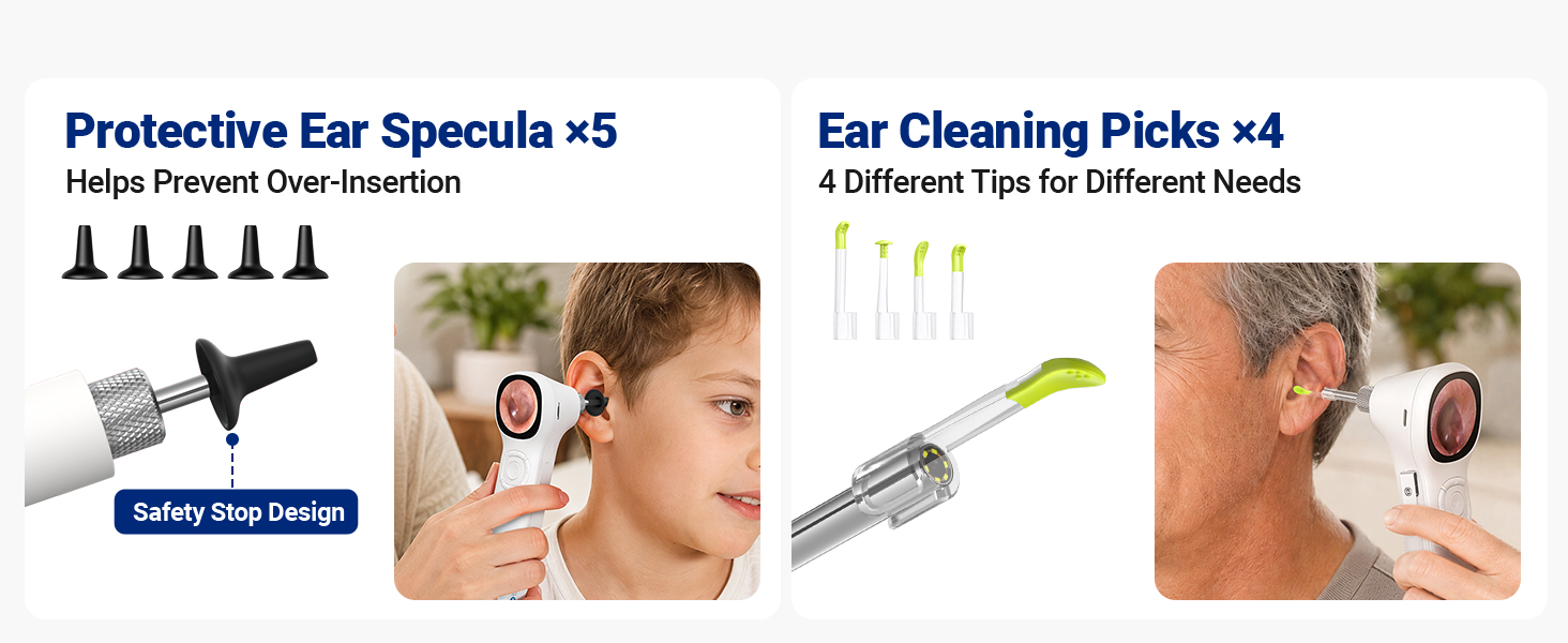 SA160 otoscope camera