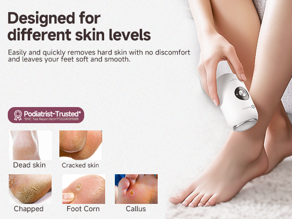 Electric Foot Callus Remover