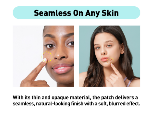 mighty patch pimple patch hero pimple patch