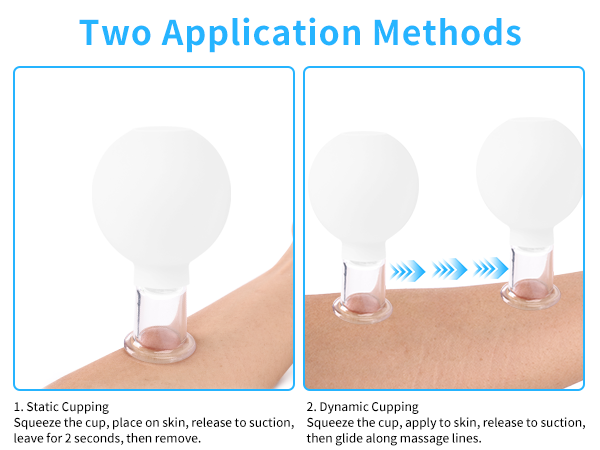 Meifuly Facial Cupping Set