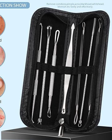effortlessly remove blackheads, whiteheads, and pimples in seconds