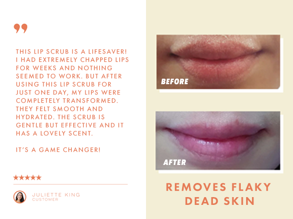 Gentle Exfoliating Lip Scrub