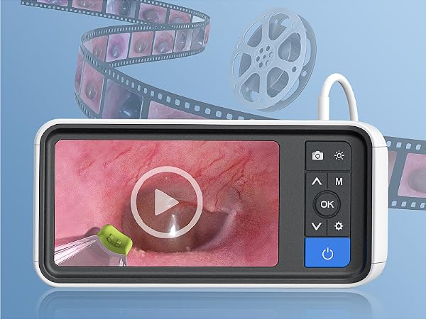 otoscope