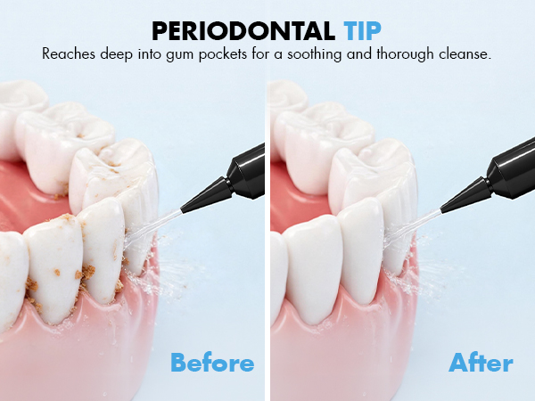 water picks for teeth cleaning and flossing