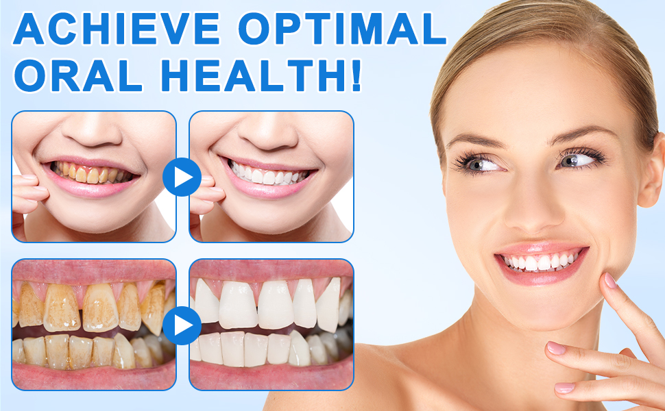 Hydroxyapatite Toothpaste