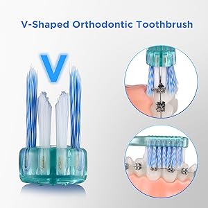 toothbrush for braces