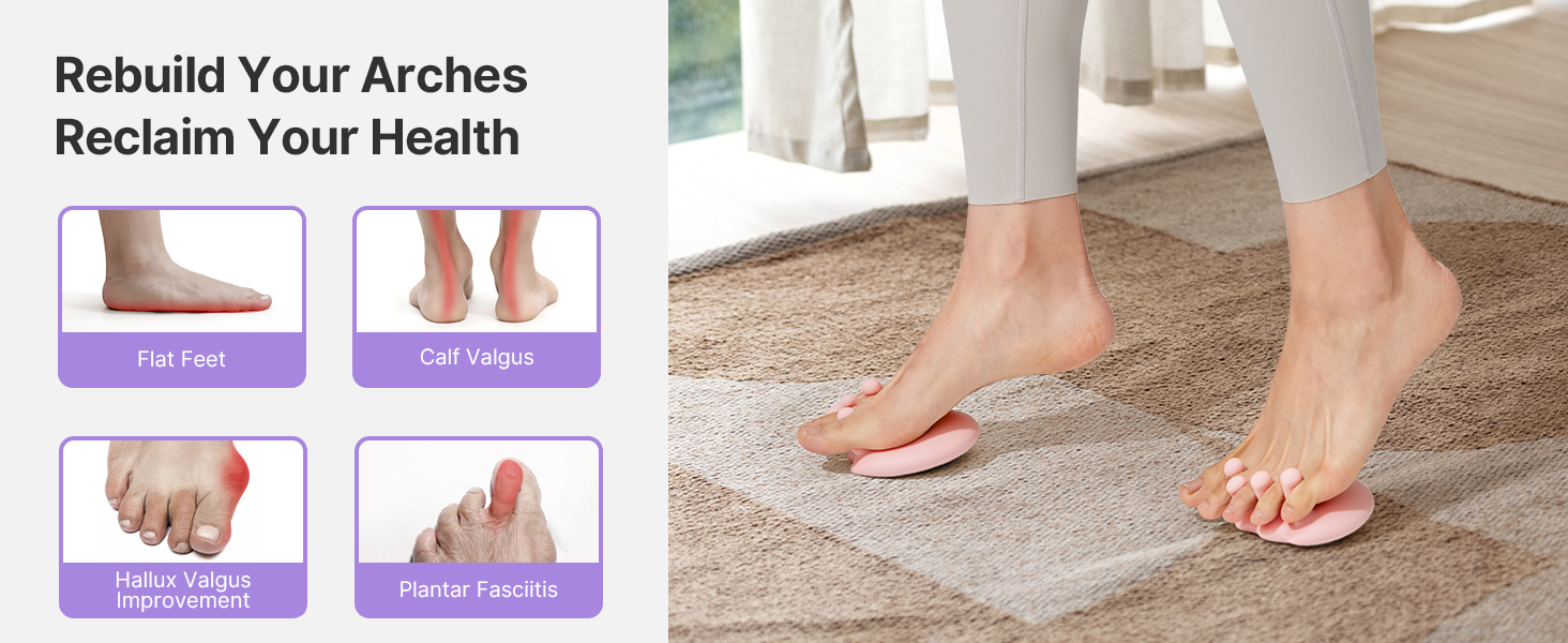 rebuild your arches