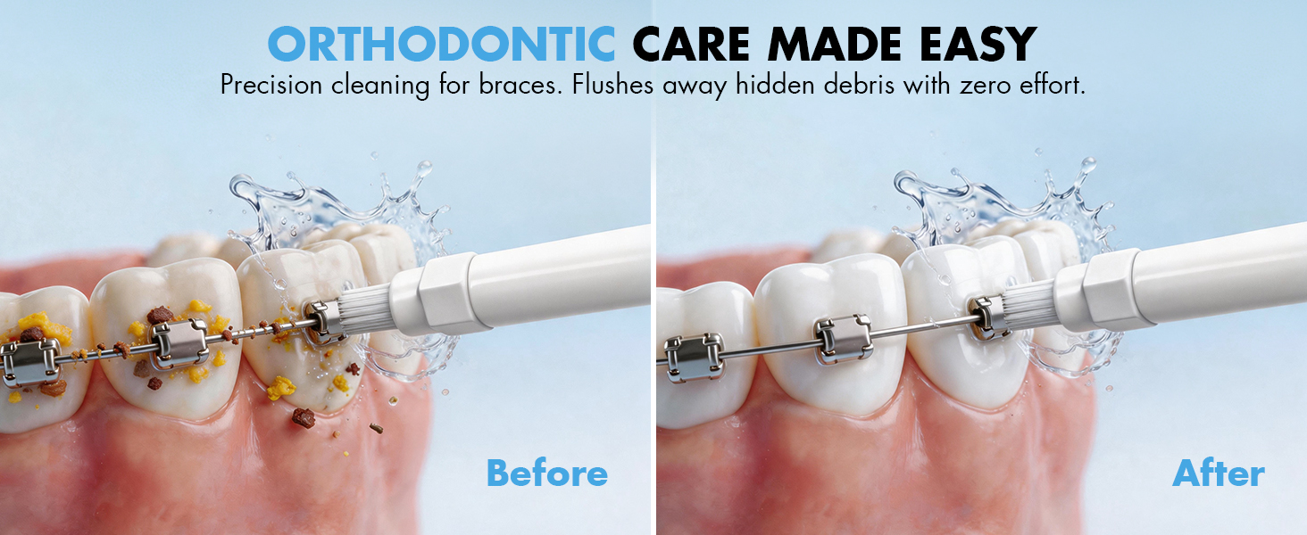 water flosser for braces