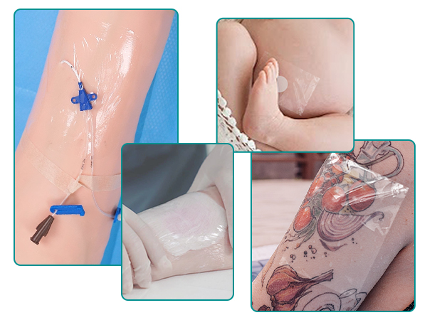 transparent film dressing