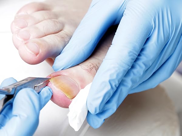 Ingrown Toenail Clippers