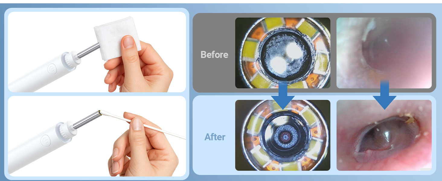 otoscope with light ear scope digital otoscope for kids smart otoscope for iphone