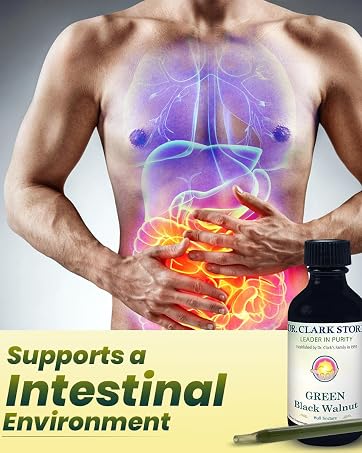 Supports Intestial Environment