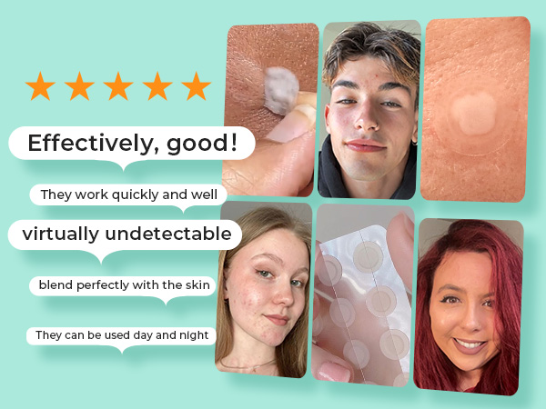 Text reads 'Effectively, good!' 'They work quickly and well' 'virtually undetectable' 'blend perfectly with the skin' 'They can be used day and night'. Customer testimonials with five-star rating and before/after photos on turquoise background.