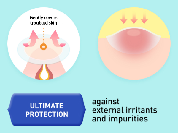 mighty patch pimple patch hero pimple patch
