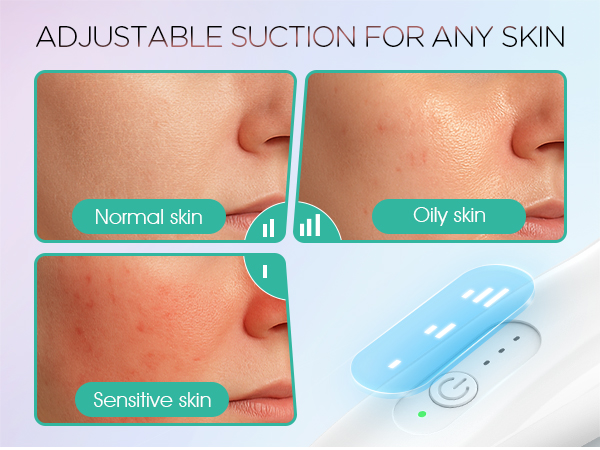 blackhead remover tools