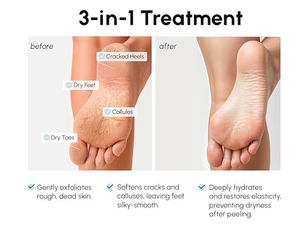 oot madk pedicure mask foot repair socks foot softening socks feet peel foot moisturizing mask