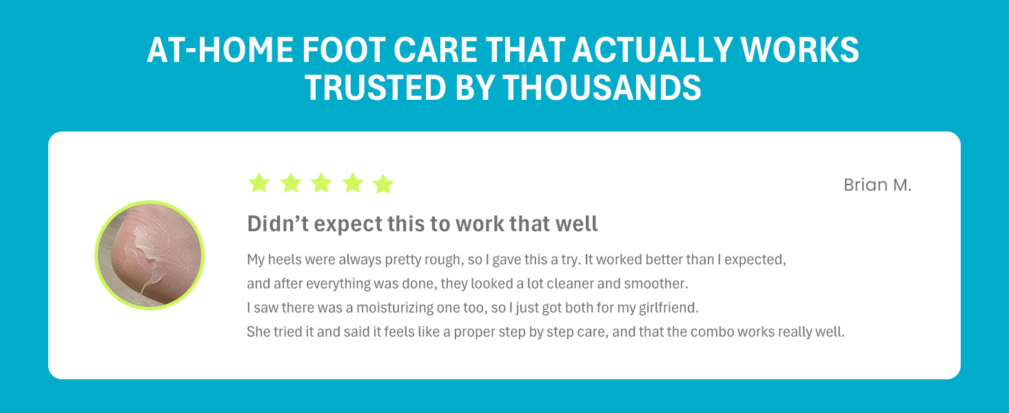 Close-up of peeling heel skin; 5-star review from Brian M. on effective foot peel mask results.