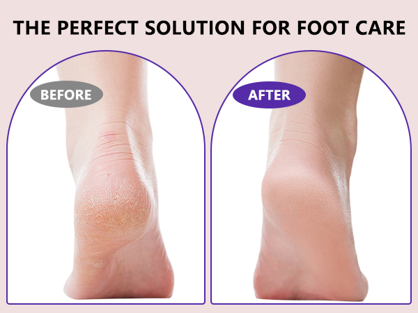 foot scrubbers