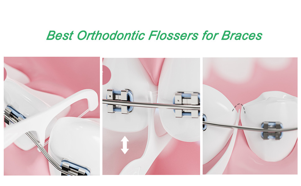 flosser