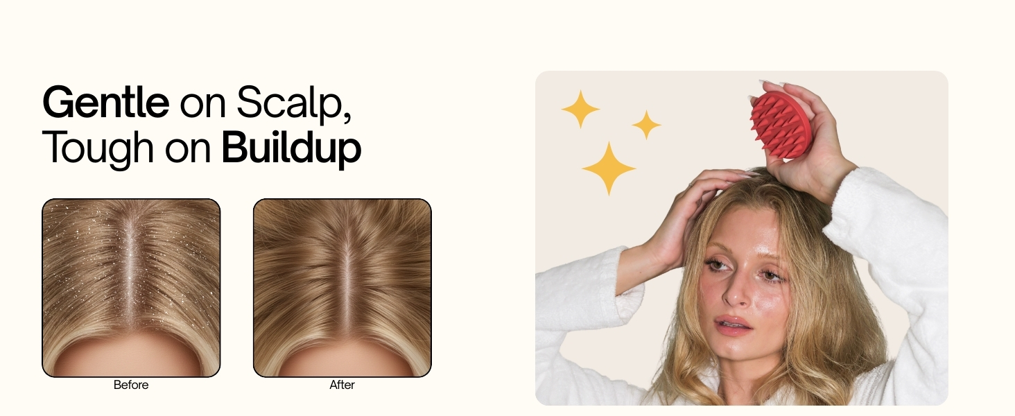 Revive on dandruff control